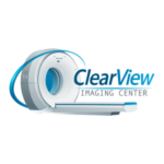 ClearView